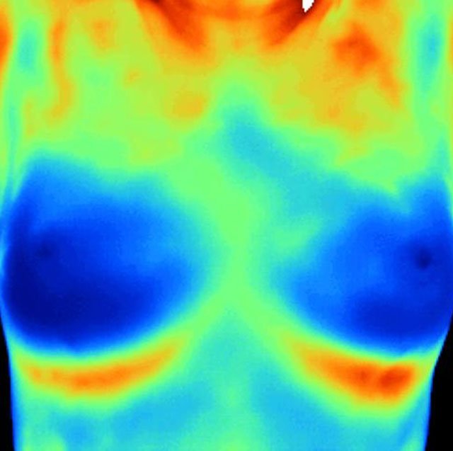 thermography